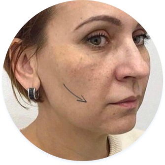 Жінка з чорними точками